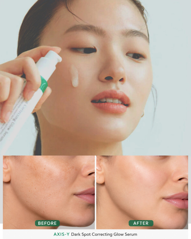 سرم ضدلک اکسیس وای (اصلی) با حجم 50 میل